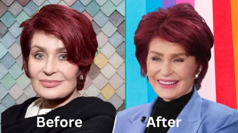 Sharon Osbourne Plastic Surgery? Did Sharon Osbourne Get Plastic Surgery? Truth Revealed