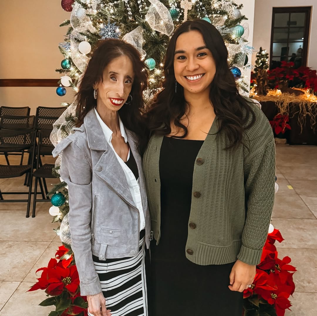 Lizzie Velasquez Biography: Net Worth, Husband, Age, Children, Wedding Photos, Syndrome Status